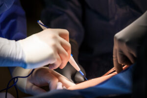 New Orleans Workforce Photographer Noel Marcantel Surgical 2