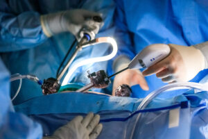 New Orleans Workforce Photographer Noel Marcantel Surgical 3