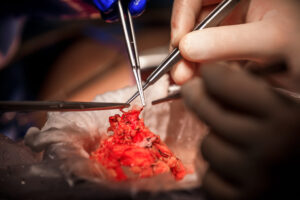 New Orleans Workforce Photographer Noel Marcantel Surgical 5